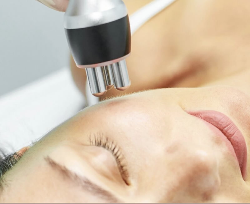 RADIO FREQUENCY (RF) TREATMENT Sincera Beauty Wellness